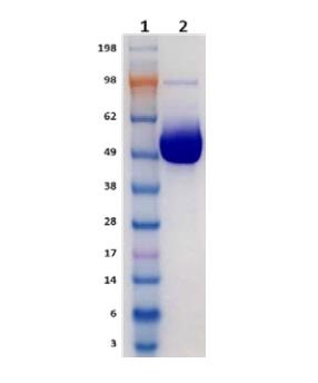 Lane 1: Molecular weight marker (SeeBlue Plus2)<br />Lane 2: HTRXR2